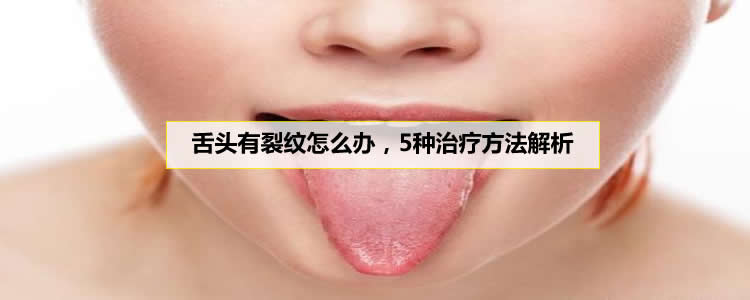 舌头有裂纹怎么办，5种治疗方法解析